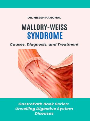 cover image of Mallory-Weiss Syndrome